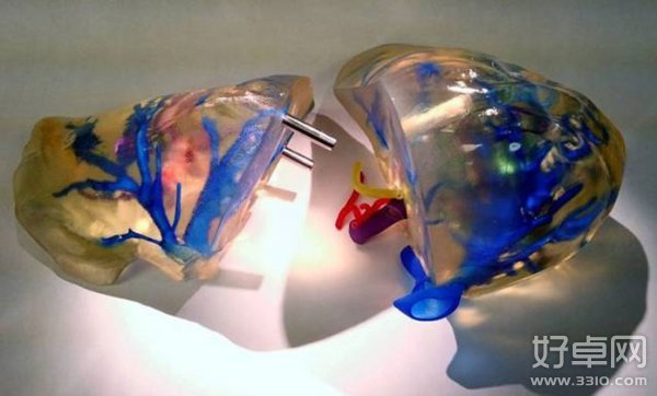 3D打印运用到医学 复制肝脏模型可供科学研究